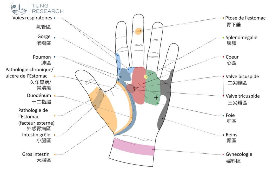 Schéma 3 — le même diagnostic, redessiné. Reproduction.
